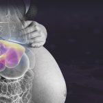 Hígado graso en el embarazo